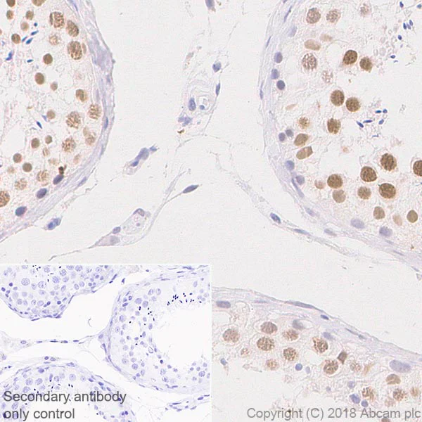 Immunohistochemistry (Formalin/PFA-fixed paraffin-embedded sections) - Anti-SIRT1 antibody [EPR18239] (AB189494)