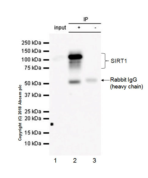 Immunoprecipitation - Anti-SIRT1 antibody [EPR18239] (ab189494), expandable thumbnail