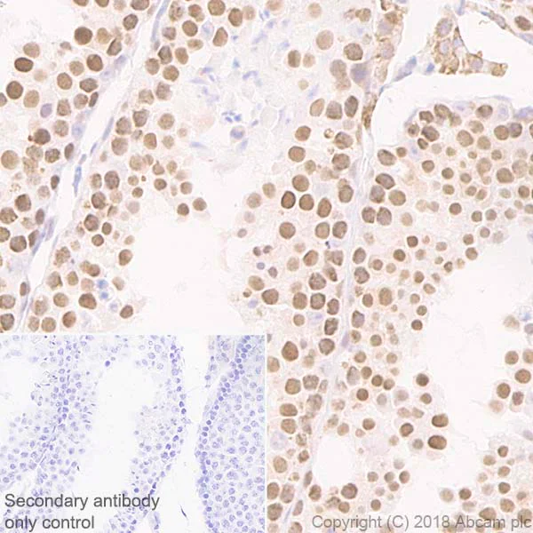 Immunohistochemistry (Formalin/PFA-fixed paraffin-embedded sections) - Anti-SIRT1 antibody [EPR18239] - BSA and Azide free (AB233398)