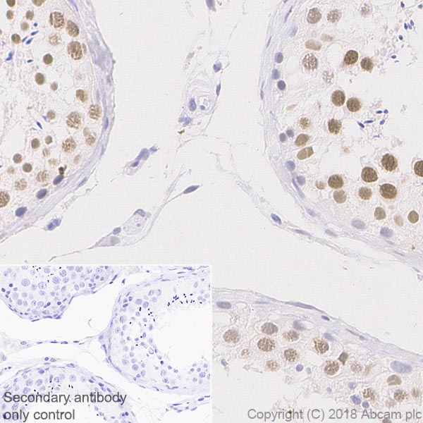 Immunohistochemistry (Formalin/PFA-fixed paraffin-embedded sections) - Anti-SIRT1 antibody [EPR18239] - BSA and Azide free (AB233398)
