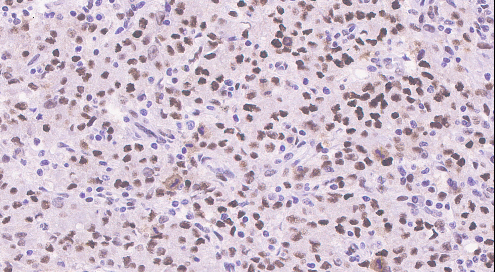 Immunohistochemistry (Formalin/PFA-fixed paraffin-embedded sections) - Anti-SIRT1 (phospho S47) antibody [EPR2849Y] (AB76039)