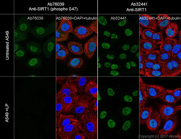 Immunocytochemistry/ Immunofluorescence - Anti-SIRT1 (phospho S47) antibody [EPR2849Y] - BSA and Azide free (AB247432)