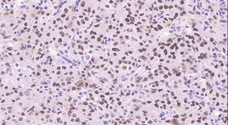 Immunohistochemistry (Formalin/PFA-fixed paraffin-embedded sections) - Anti-SIRT1 (phospho S47) antibody [EPR2849Y] - BSA and Azide free (AB247432)