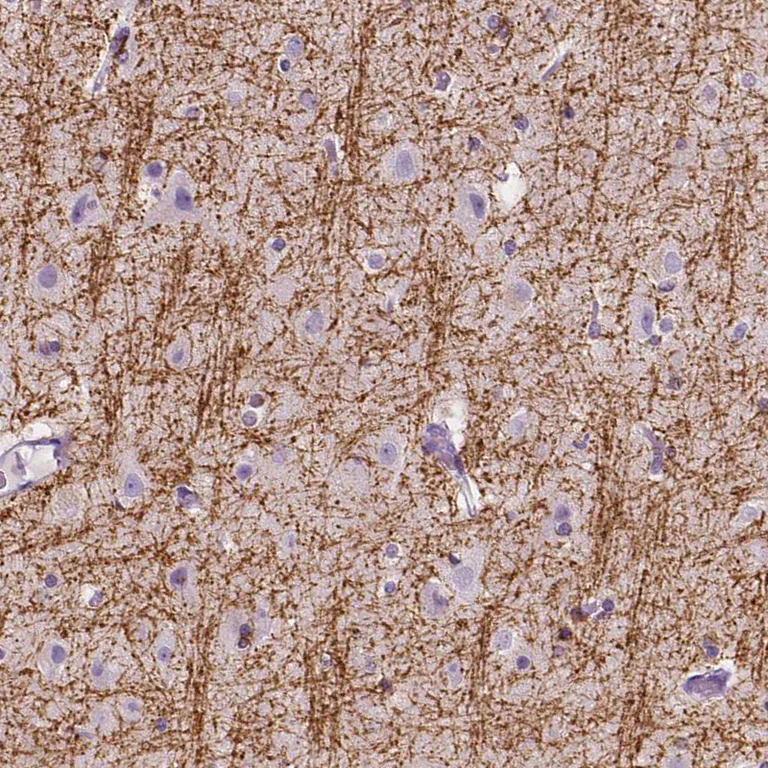 Immunohistochemistry (Formalin/PFA-fixed paraffin-embedded sections) - Anti-SIRT2 Antibody (AB327191)