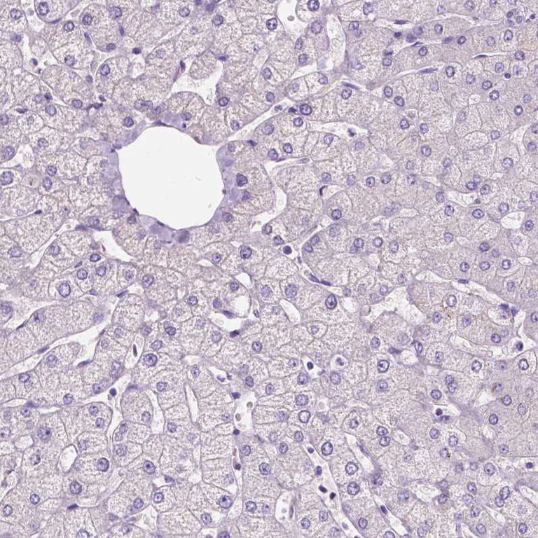 Immunohistochemistry (Formalin/PFA-fixed paraffin-embedded sections) - Anti-SIRT2 Antibody (AB327191)