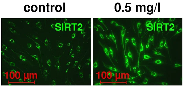 Immunocytochemistry - Anti-SIRT2 antibody (AB67299)