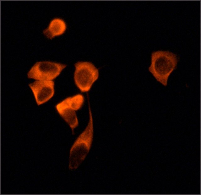 Immunocytochemistry - Anti-SIRT2 antibody (AB67299), expandable thumbnail
