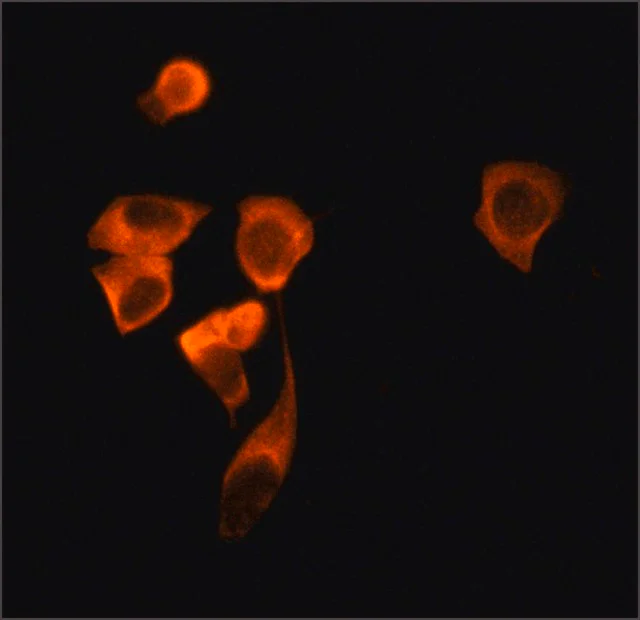 Immunocytochemistry - Anti-SIRT2 antibody (AB67299)