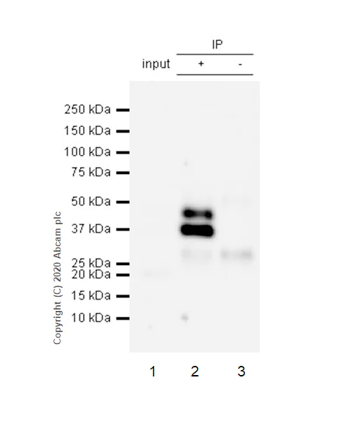 Immunoprecipitation - Anti-SIRT2 antibody [EP1668Y] - BSA and Azide free (AB239838)