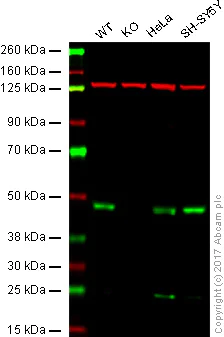 Western blot - Anti-SIRT2 antibody [EPR1667] (AB134171)