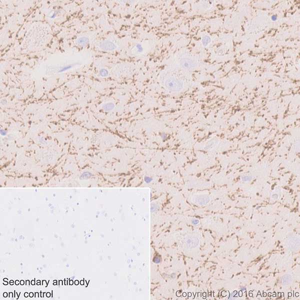 Immunohistochemistry (Formalin/PFA-fixed paraffin-embedded sections) - Anti-SIRT2 antibody [EPR20411-105] (AB211033)