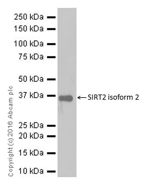 Western blot - Anti-SIRT2 antibody [EPR20411-105] (AB211033)