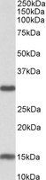 Western blot - Anti-SIRT3 antibody (AB118334)