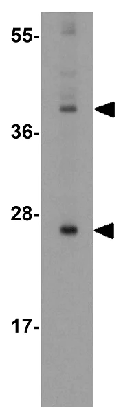 Western blot - Anti-SIRT3 antibody (AB254562)