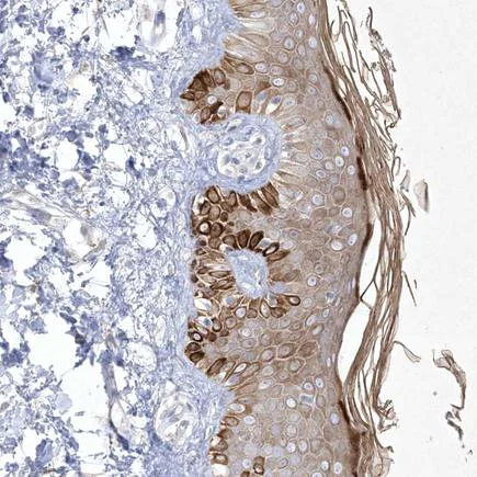 Immunohistochemistry (Formalin/PFA-fixed paraffin-embedded sections) - Anti-SIRT3 antibody (AB260049)