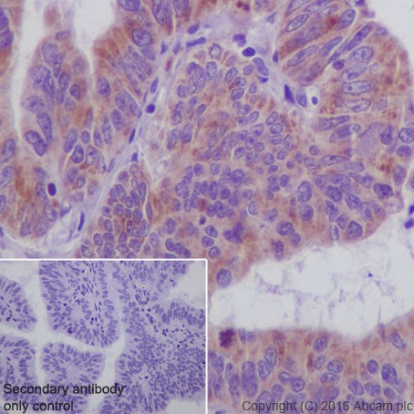 Immunohistochemistry (Formalin/PFA-fixed paraffin-embedded sections) - Anti-SIRT3 antibody [EPR19755] (AB217319)