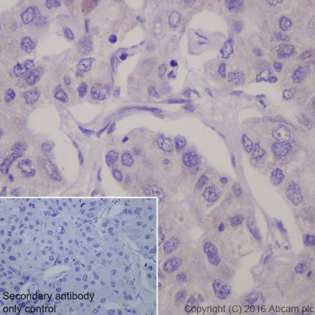 Immunohistochemistry (Formalin/PFA-fixed paraffin-embedded sections) - Anti-SIRT3 antibody [EPR19755] (AB217319)