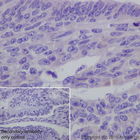 Immunohistochemistry (Formalin/PFA-fixed paraffin-embedded sections) - Anti-SIRT3 antibody [EPR19755] (AB217319)