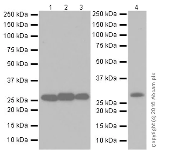 Western blot - Anti-SIRT3 antibody [EPR19755] (AB217319)
