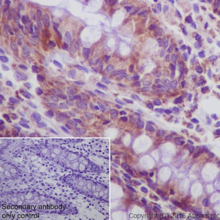 Immunohistochemistry (Formalin/PFA-fixed paraffin-embedded sections) - Anti-SIRT3 antibody [EPR19755] - BSA and Azide free (AB223531)
