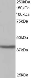 Western blot - Anti-SIRT4 antibody (AB10140)