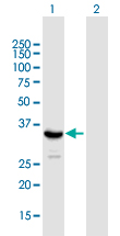 Western blot - Anti-SIRT4 antibody (AB168679)