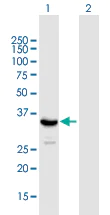 Western blot - Anti-SIRT4 antibody (AB168679)