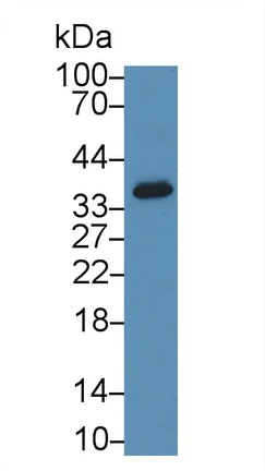 Western blot - Anti-SIRT4 antibody (AB231137)