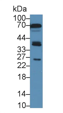 Western blot - Anti-SIRT4 antibody (AB231137)