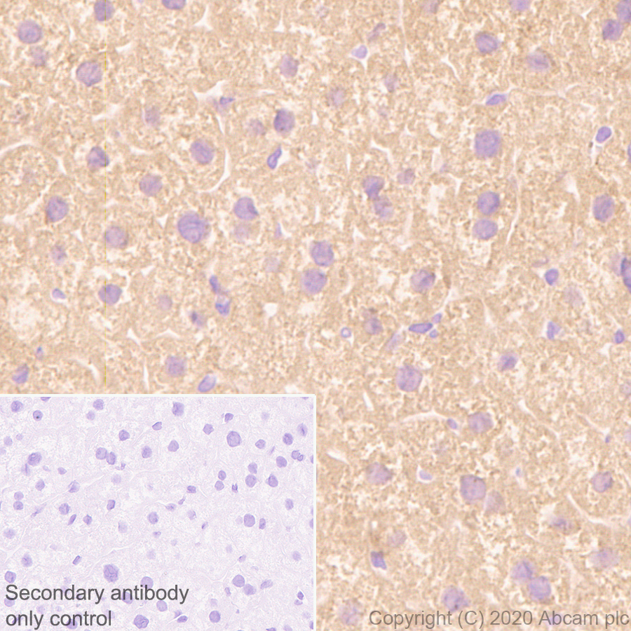 Immunohistochemistry (Formalin/PFA-fixed paraffin-embedded sections) - Anti-SIRT5 antibody [EPR23787-116] - BSA and Azide free (ab275031), expandable thumbnail