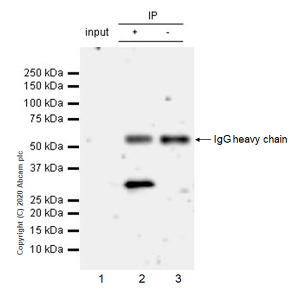 Immunoprecipitation - Anti-SIRT5 antibody [EPR23787-116] - BSA and Azide free (AB275031), expandable thumbnail