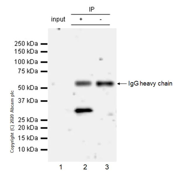 Immunoprecipitation - Anti-SIRT5 antibody [EPR23787-116] - BSA and Azide free (AB275031)