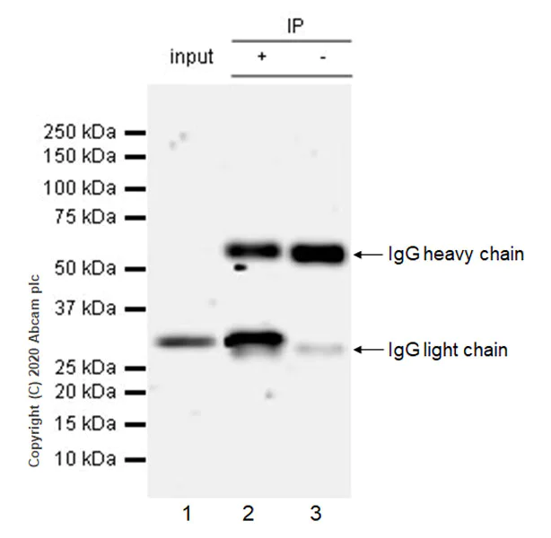 Immunoprecipitation - Anti-SIRT5 antibody [EPR23787-116] - BSA and Azide free (AB275031)