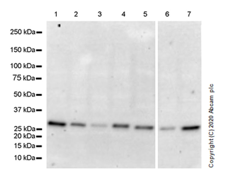 Western blot - Anti-SIRT5 antibody [EPR23787-116] - BSA and Azide free (AB275031), expandable thumbnail