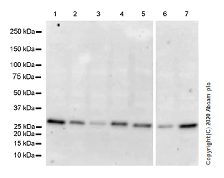 Western blot - Anti-SIRT5 antibody [EPR23787-116] - BSA and Azide free (AB275031)