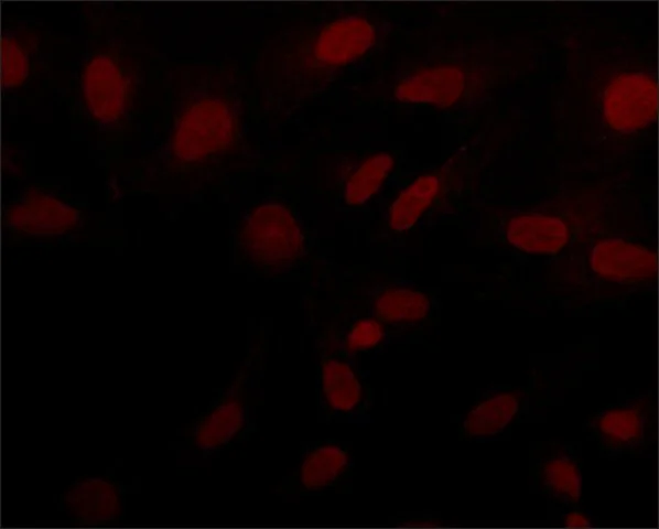 Immunocytochemistry - Anti-SIRT6 antibody (AB62739)