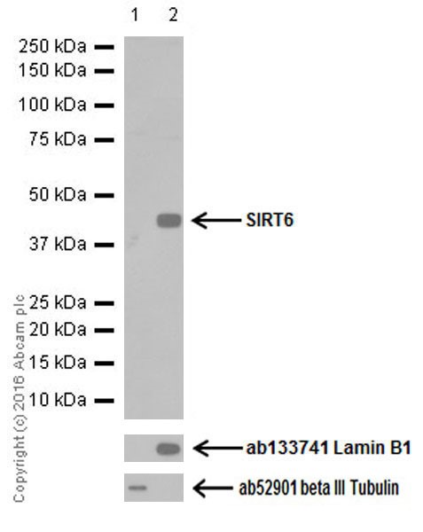 Western blot - Anti-SIRT6 antibody [EPR18463] (AB191385)