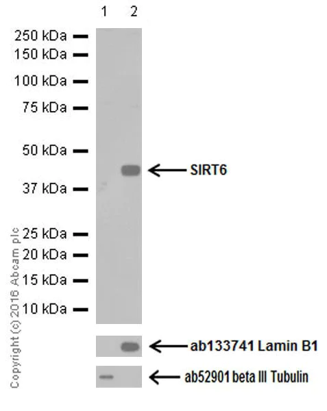 Western blot - Anti-SIRT6 antibody [EPR18463] (AB191385)
