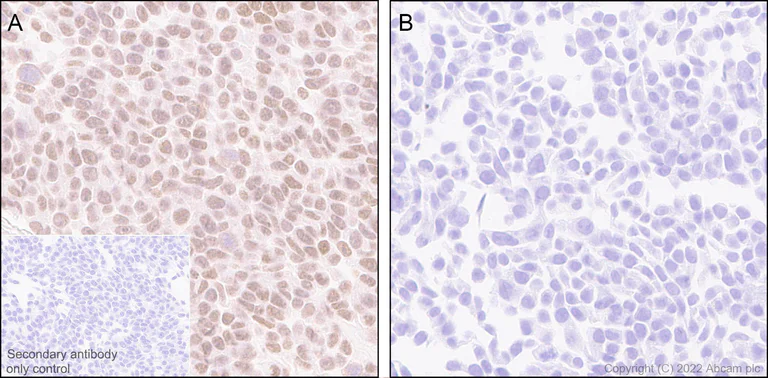Immunohistochemistry (Formalin/PFA-fixed paraffin-embedded sections) - Anti-SIRT6 antibody [EPR26255-85] - BSA and Azide free (AB289995)