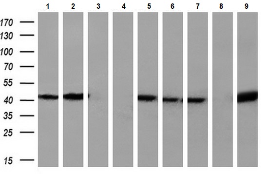 Western blot - Anti-SIRT6 antibody [OTI1G3] (AB119007)