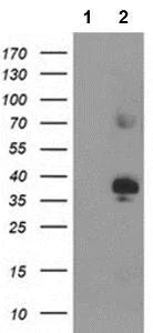 Western blot - Anti-SIRT6 antibody [OTI1G3] (AB119007)