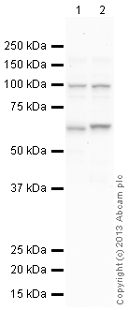 Western blot - Anti-Site-1 Protease antibody (AB140592)