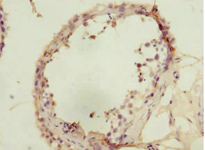 Immunohistochemistry (Formalin/PFA-fixed paraffin-embedded sections) - Anti-SIVA antibody (AB224595)