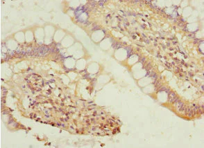 Immunohistochemistry (Formalin/PFA-fixed paraffin-embedded sections) - Anti-SIVA antibody (AB224595)