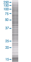 SIVA overexpression 293T lysate (whole cell)