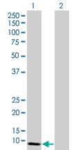 Western blot - SIVA overexpression 293T lysate (whole cell) (AB94199)