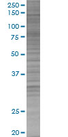 SIVA overexpression 293T lysate (whole cell)