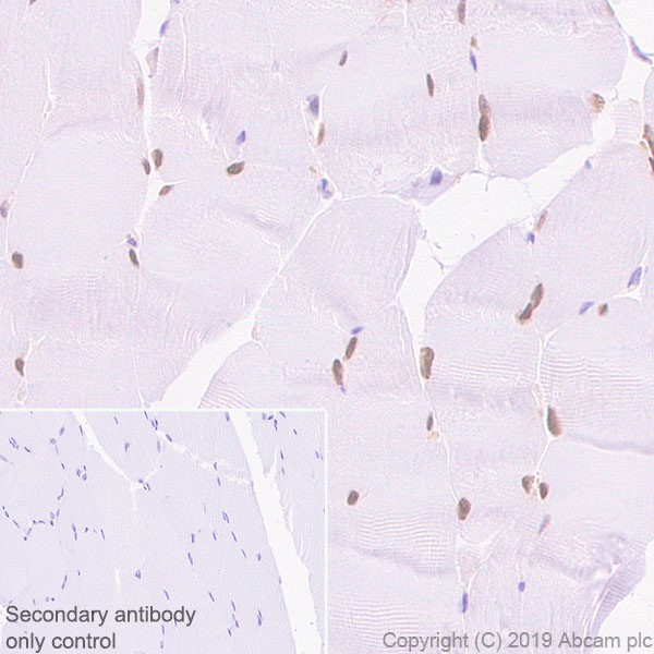 Immunohistochemistry (Formalin/PFA-fixed paraffin-embedded sections) - Anti-SIX1 antibody [1593] (AB243247), expandable thumbnail