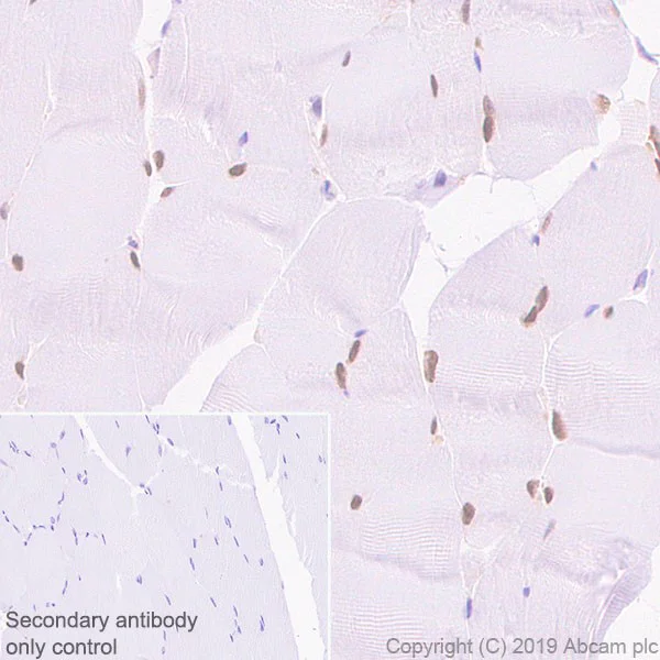 Immunohistochemistry (Formalin/PFA-fixed paraffin-embedded sections) - Anti-SIX1 antibody [1593] (AB243247)