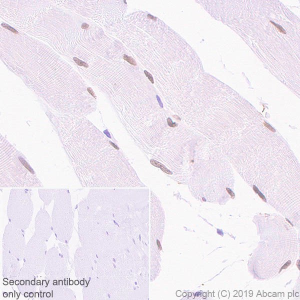 Immunohistochemistry (Formalin/PFA-fixed paraffin-embedded sections) - Anti-SIX1 antibody [1593] (AB243247), expandable thumbnail